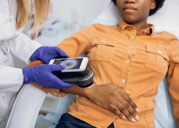 ia diagnosticos dermatologicos